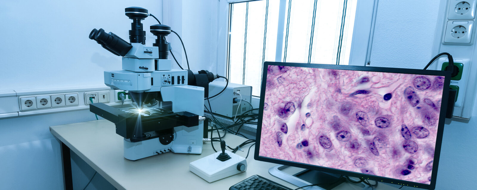 Image of a monitor with a close up of the cell on the screen, being seen through the use of the microscope on the left that is plugged in.