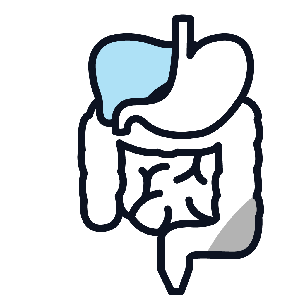 This is an image of a peritoneal mesothelioma bath.