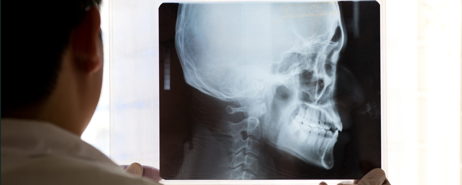 This is an image of a doctor holding up a laryngeal scan.