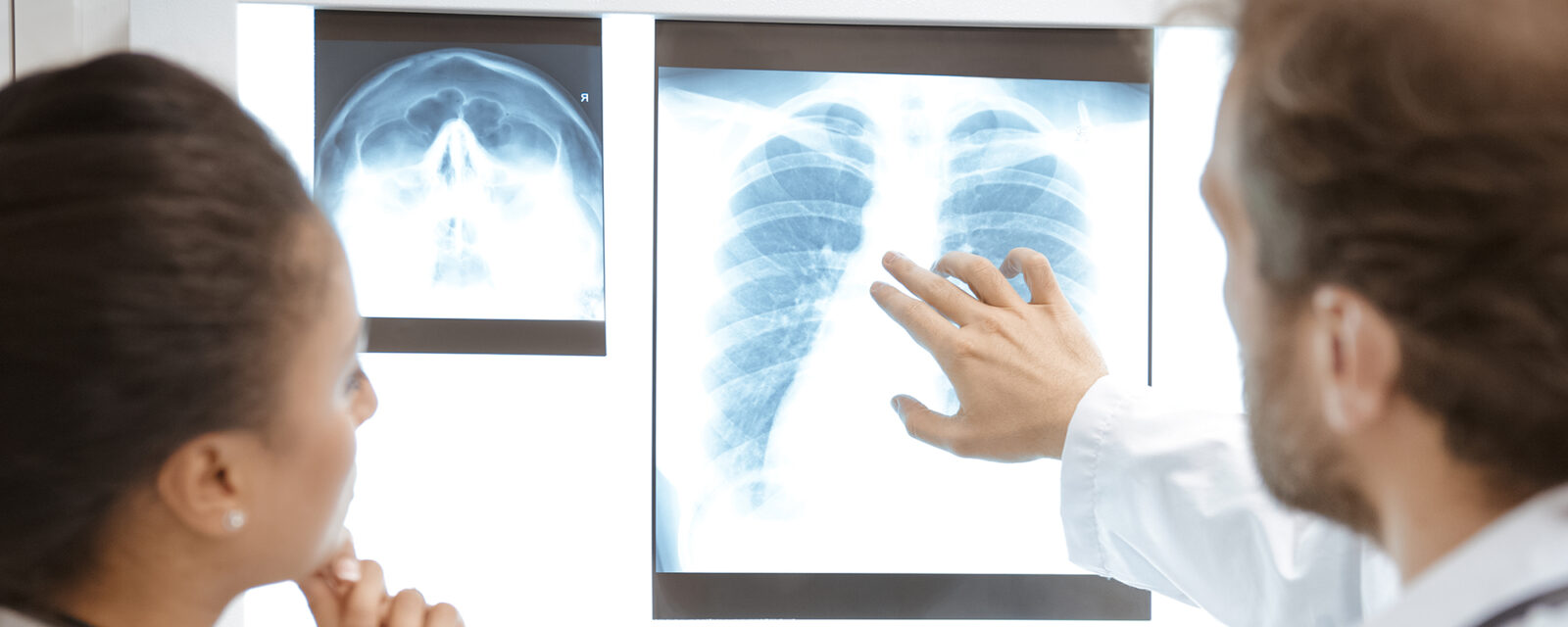 This is an image of two doctors analyzing a pericardial mesothelioma scan.