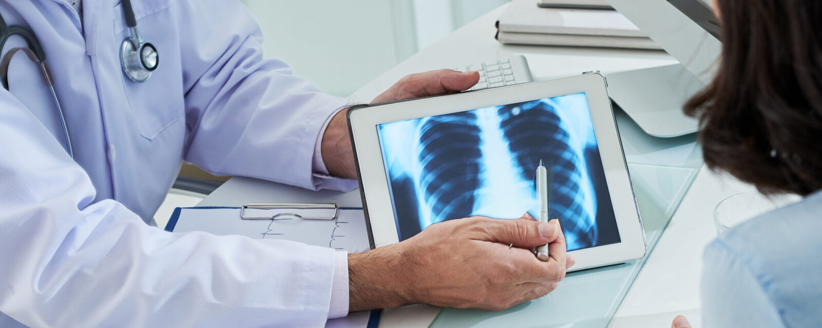 This is an image of a medical professional showing a patient their pleural mesothelioma scan.