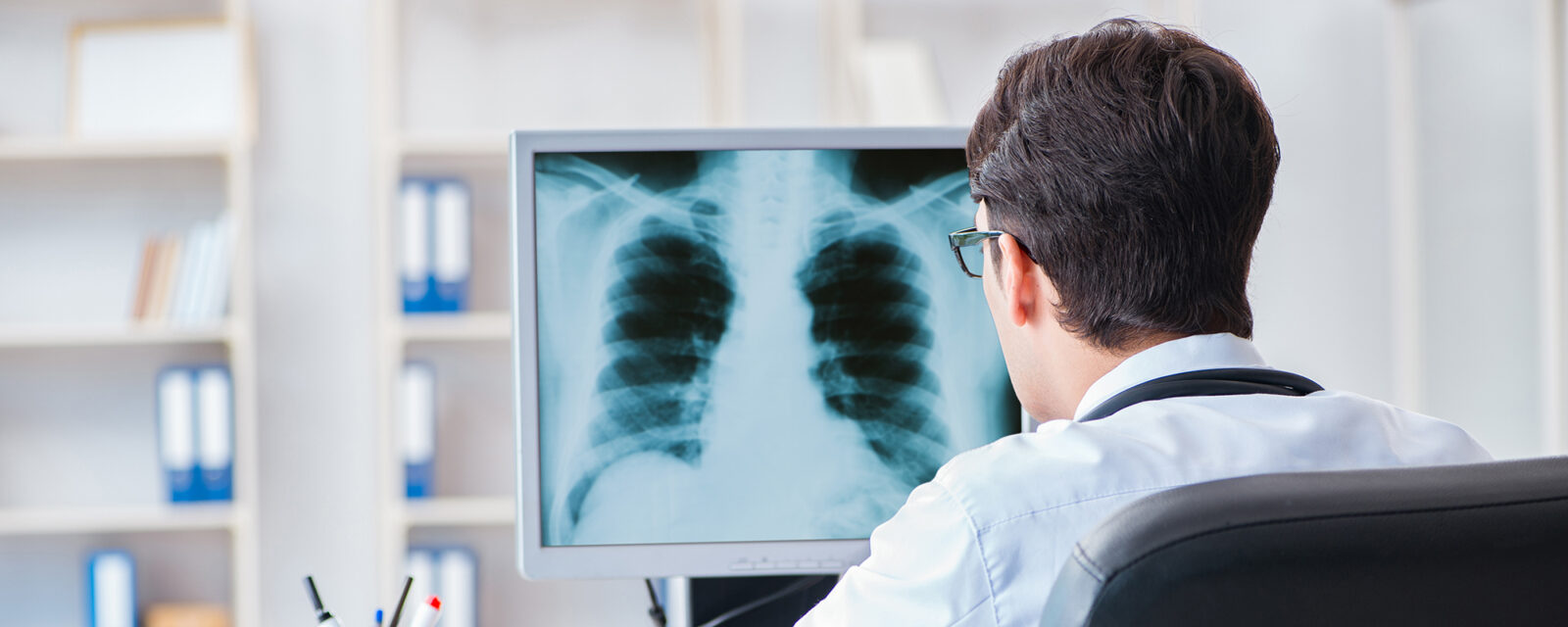 Rear view image of a doctor viewing a mesothelioma scan on a monitor.