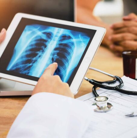 Lung x-ray on tablet being used by doctor to explain situation. Patient is sitting across the desk on the other side with folded hands.