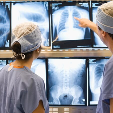 Photo of doctors examining a chest x-ray or ct scan for mesothelioma patients.