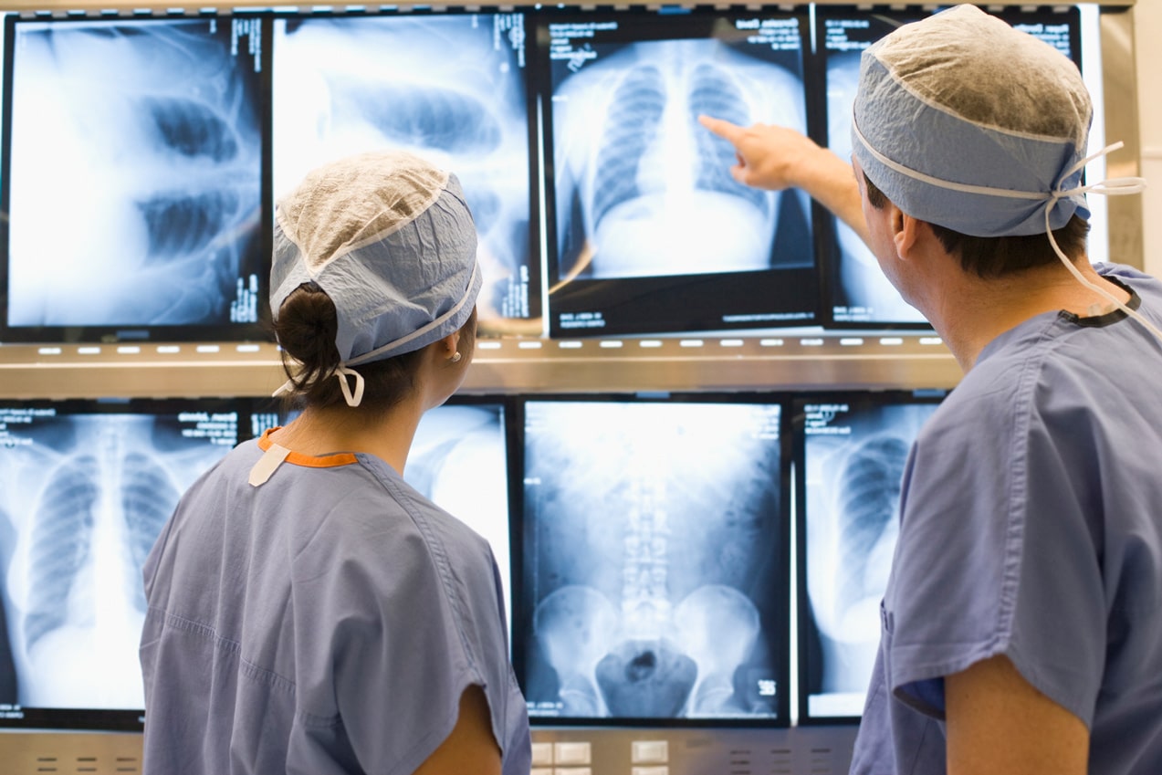 Photo of doctors examining a chest x-ray or ct scan for mesothelioma patients.