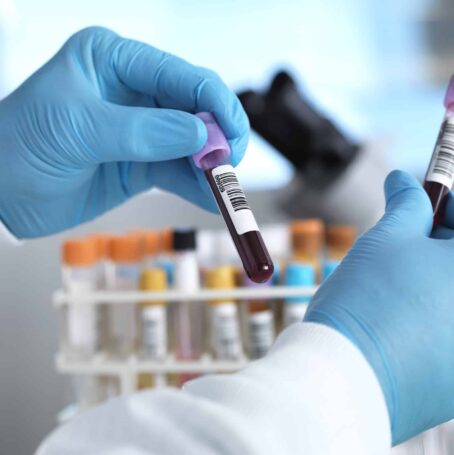 Lab worker holds blood test for mesothelioma.
