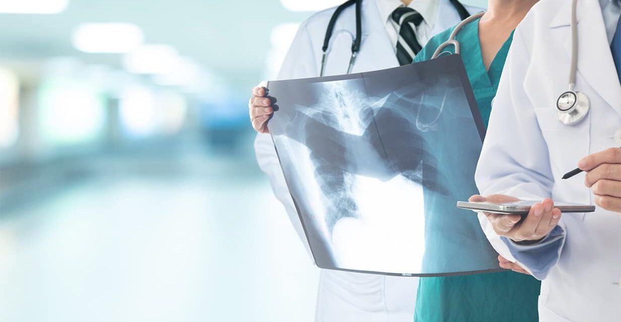 Doctors holding lung x-ray.